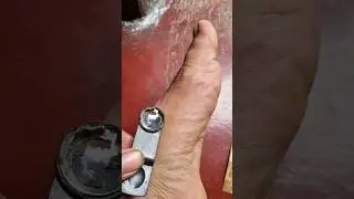 Little ant bite zoom test 😳 || macro photography 🔥 | #viral #shorts #short
