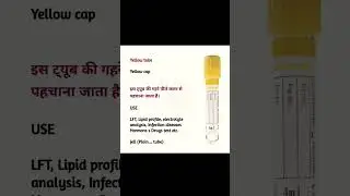 Different types of Vial for blood collection, Blood collection tube l blood sample vial,#shortvideo