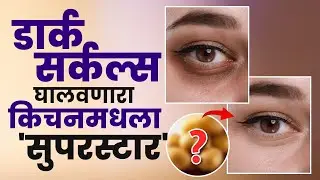 Dark Circles, Tanning घरीच करा गायब ! हा उपाय आहे गॅमेचेंजर | Dark Circles And Tanning | GA2