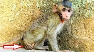 Millions sad, Poor Baby Janna Fracture Left Leg Can't Walk, Now she's Very thin and Drowsiness.