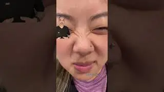 Botox For Nose Wrinkles, Bunny Lines
