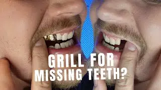 Using Gold Caps or Grillz for Missing Teeth? Is it a Good Idea?