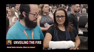Jesus heals Brazilian woman with 3 metal bolts in her arm (miracle)