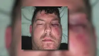Man believes he and boyfriend were beaten outside Ameristar Casino because they're gay