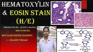Hematoxylin and Eosin Stain (H/E) class by Sunita ma'am @MLTclass 🩸DMLT - BMLT Important Topic 💯💯🏆🏆