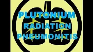WIPP Lung: Hiding Plutonium  Pneumonitis