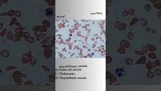 Anaemia Quiz 01