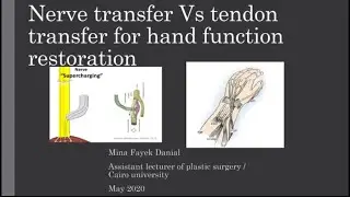 Nerve tr. Vs. Tendon tr. for hand function restoration part 1