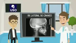 Rx  Lateral de Cr&aacute;neo