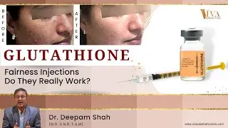Glutathione Skin Whitening Injection | Glutathione Benefits | Fairness injection treatment