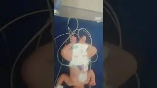 #new video New born baby patient care 😘 ll🫶🏻🏥👀