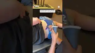Signs of nerve healing, nerve regeneration