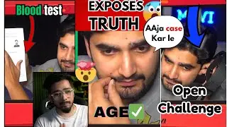 Mavi  Exposes Scout😲 Open Challenge* Kar le Case'' See..❓