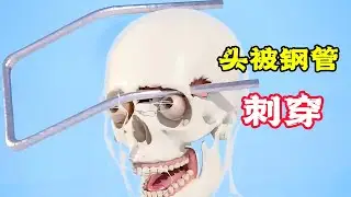 男人太粗心，頭被鐵棒刺穿，這可怎麼辦？科普動畫《刺穿頭部》。電影，短片，成精，解說，搞笑，動畫，動作，喜劇，獵奇，奇幻，腦洞，科幻，超能力，short film