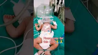 Icu Baby Care❤#newbornbaby #newborn #icu #baby #cute #trending #trendingshorts #shortvideo #nicu