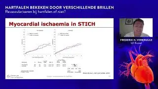 Revasculariseren bij hartfalen of niet? Dat is de vraag....