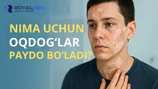 Oq dog'lar paydo bo'lishining asosiy sababi | Oq dog'lar qaytalanmasligi uchun nima qilish kerak?