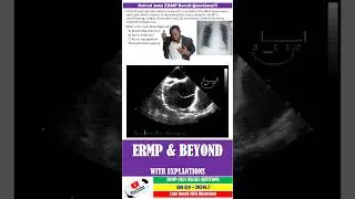 ERMP Case - 15 - Aortic Syndromes