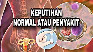 Keputihan itu normal atau penyakit?