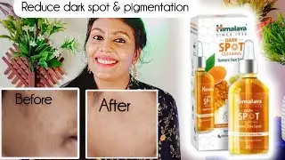 HIMALAYA Spot clearing TURMERIC face Serum / Affordable Best Serum