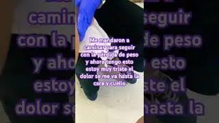 #horror #ciaticapiernaizquierda  #inflamacion  #dolordepierna  #masaje #dolorecronico