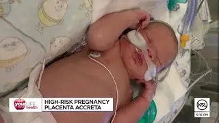 Utah mom, doctor shed light on high-risk pregnancy diagnosis