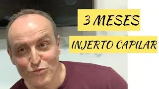 INJERTO CAPILAR 3 MESES