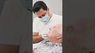 All on 6 Implants - Patient Review - Acardent Turkey