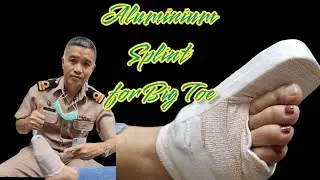 Aluminium Splint of Big Toe