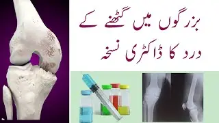 Best Suppliments For Bone And Cartilage Repair 💊💉 | Ghutnon K Dard Ka Ilaj 🩺