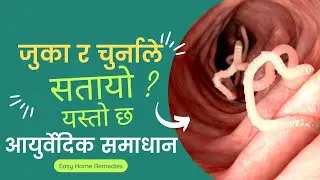 जुका र चुर्ना बाट मुक्त हुन यसो गर्नुहोस् । This is the Ayurvedic remedy for worms and worms