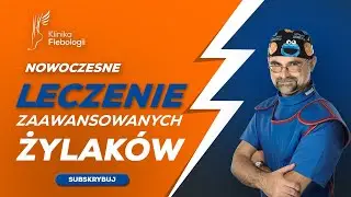 Nowoczesne leczenie zaawansowanych żylaków (Klinika Flebologii)