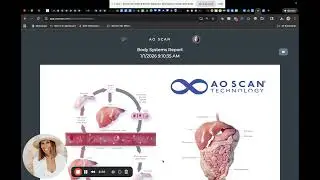 Utilizing AOScan and AI for Energetic Health Insights