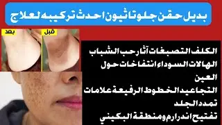 بديل حقن جلوتاثيون احدث تركيبه لعلاج التصبغات والكلف التجاعيد الهالات السوداء تفتيح اندرارم والبكينى