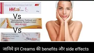 Beauty Creams के benefits और side effects | Skinshine Vs Melacare Vs HH Lite Vs Mis Glow Cream|
