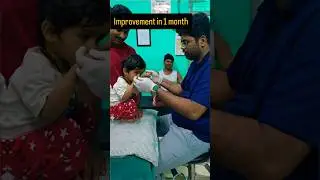 #bhuvikatv #physiotherapist #physiotherapy #jan25 #shortsfeed #shorts