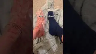 Baby foot peel for dry feet! So gross but so satisfying and it works do well