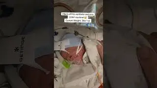 Preemie Baby Journey #nicu #preemiebaby #micropreemie #nicubaby #preemies