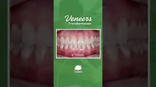 1 Day Smile Makeover