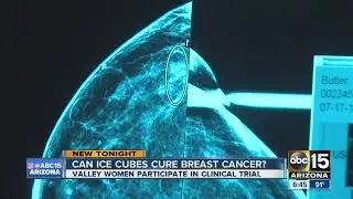 Can ice cubes cure breast cancer?