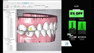CERIK3D- O3D v6.0- Interval/ Hole/ Label- Orchestrate3D-Alineadores Transparentes+AI-AREA3D-video 8