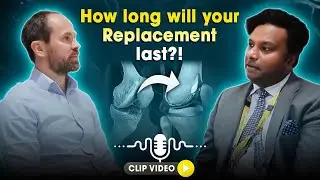 Knee replacement longevity: How long can you expect your knee replacement to last?