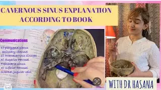 Cavernous sinus Anatomy | Tributaries | Relations | Communications | Clinicals