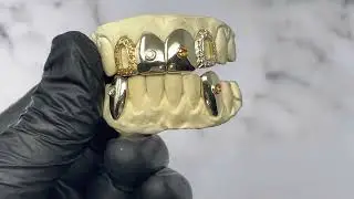 Custom Diamond and Orange Sapphire Grillz w Open Faces - Luxe Grillz