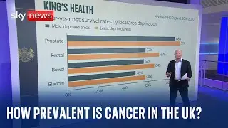 How prevalent is cancer in the UK, and what are the most common types to be diagnosed with?