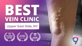 Best Vein Clinic in the Upper East Side, NY