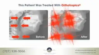 GROWTH GUIDANCE; AIRWAYS, Kimberly Hubenette/ Synergy Dental Group