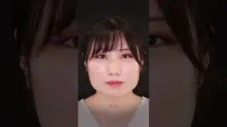 エラの張りを改善！ #TAクリニック #エラボト