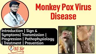 Monkeypox Virus Disease | By AU Sir | Medical Lectures by AU Sir