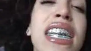 SUPERSTAR GRILLS - Sneeze Rap - TheRealParis